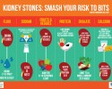 Kidney Stones: Smash Your Risk To Bits!